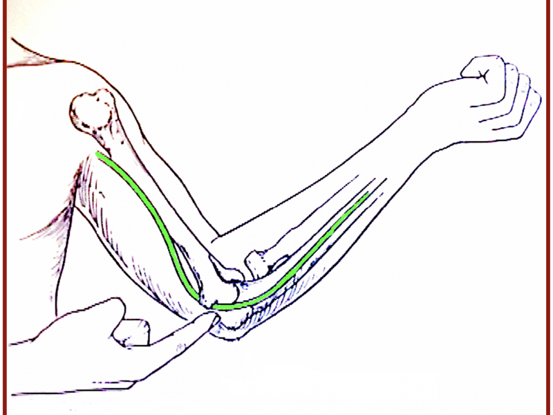 pathologie Centre de consultations de la main épaule et membre inferieur guadeloupe