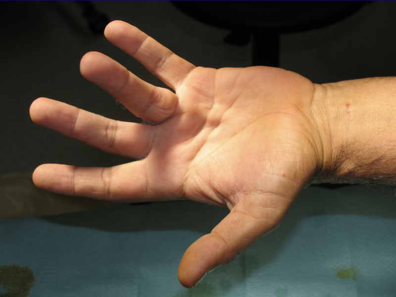 pathologie Centre de consultations de la main épaule et membre inferieur guadeloupe