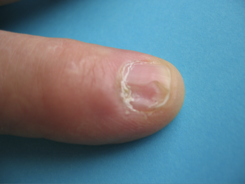 pathologie Centre de consultations de la main épaule et membre inferieur guadeloupe