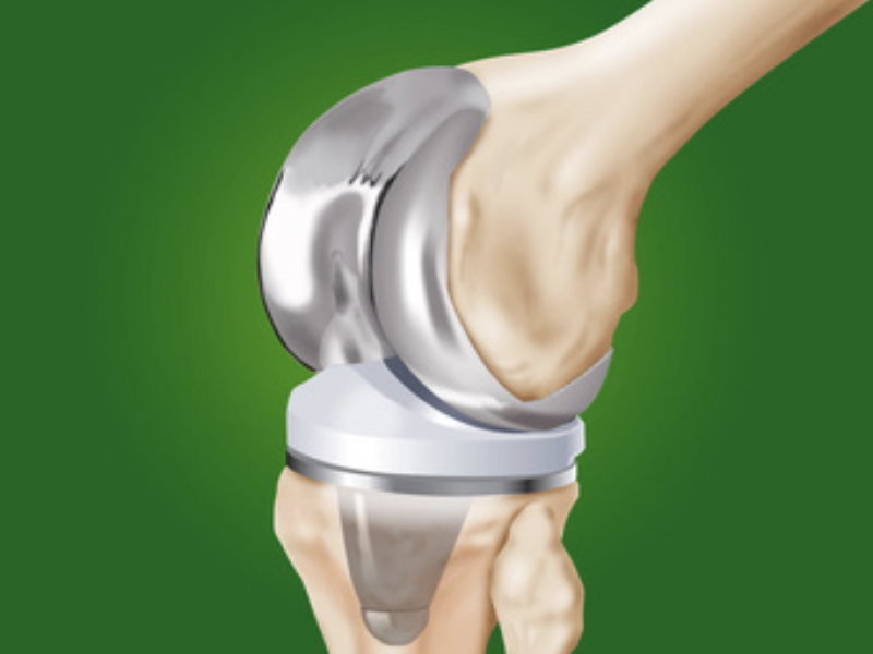 pathologie Centre de consultations de la main épaule et membre inferieur guadeloupe