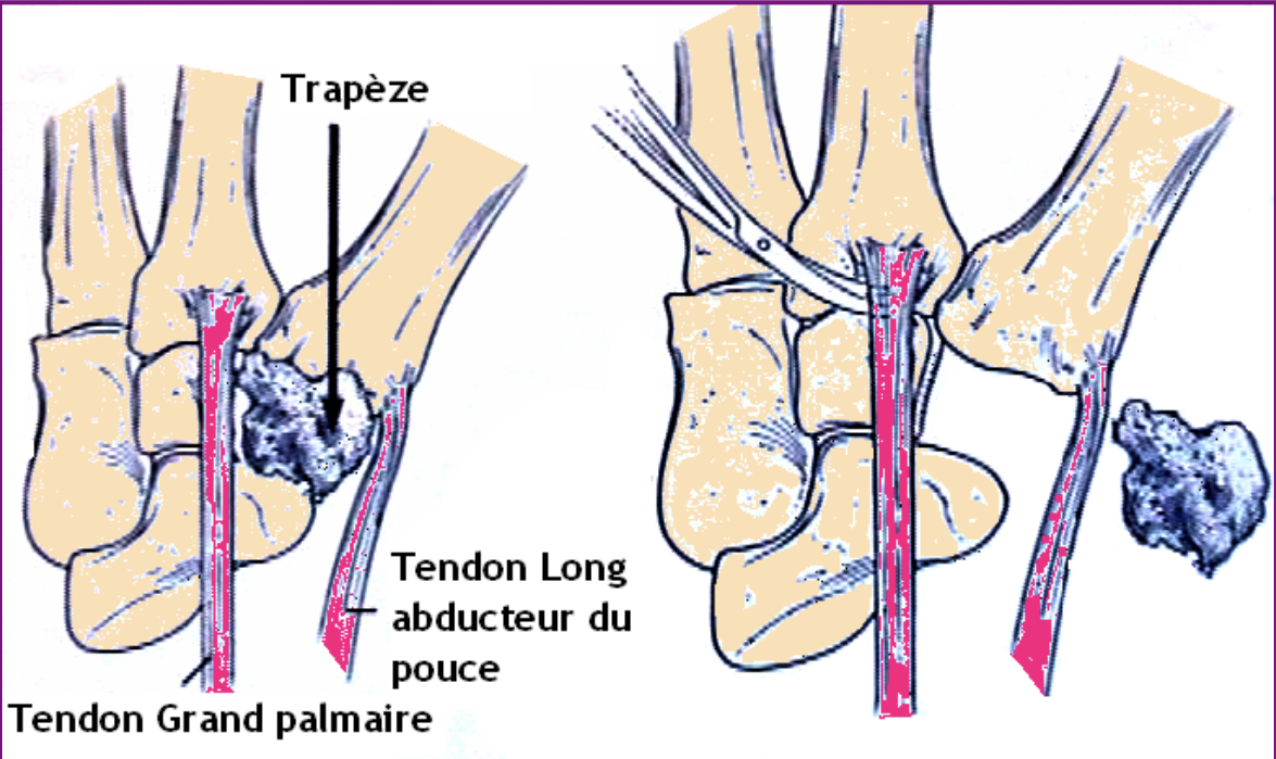 pathologie Centre de consultations de la main épaule et membre inferieur guadeloupe